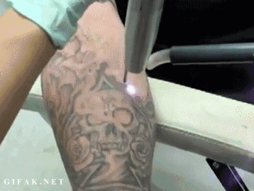 1.gif